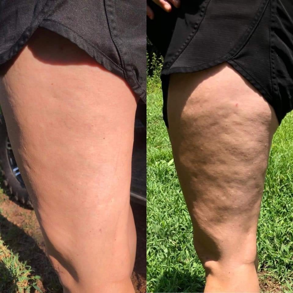 Dermatic Effects Firming Cream